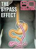 60 Minutes - The Bypass Effect (April 20, 2008)