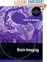 Brain Imaging: Case Review Series, 1e
