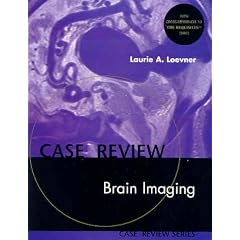 Brain Imaging: Case Review Series