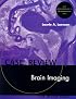 Brain Imaging: Case Review Series (Case Review)