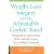 Weight Loss Surgery with the Adjustable Gastric Band: Everything You Need to Know Before and After Surgery to Lose Weight Successfully
