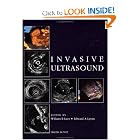 Invasive Ultrasound by William R Lees and Edward Lyons
