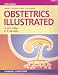 Obstetrics Illustrated by Alistair W. F. Miller ISBN 0443050414