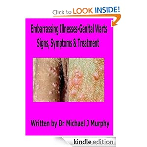 Genital Warts Signs