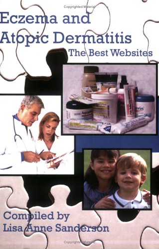 Eczema and Atopic Dermatitis: The Best Websites