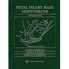Click here to buy Fetal Heart Rate Monitoring (Freeman, Fetal Heart Rate Monitoring) by Roger K. Freeman, Thomas J Garite, and Michael P Nageotte.
