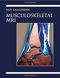 Musculoskeletal MRI