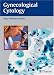 Gynecologic Cytology