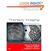 Thoracic Imaging: Case Review Series, 2e