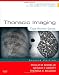 Thoracic Imaging: Case Review Series, 2e
