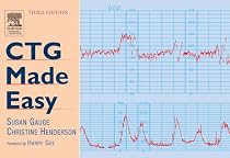 CTG Made Easy