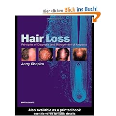Hair Loss: Principles of Diagnosis and Management of Alopecia: Principles of Diagnosis and Management of Hair Loss