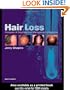 Hair Loss: Principles of Diagnosis and Management Alopecia