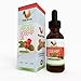 100% Pure & Natural, Certified ORGANIC Rosehip Seed Oil HUGE 2oz Bottle! Works Or Your Money Back! Highly-Potent For All Skin Types, Anti-Aging, Wrinkles, Heal Acne Scars, Burns, Age Spots Or Dry Brittle Hair! No Chemicals! Spa Quality From Aveya Beauty