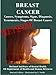 BREAST CANCER Causes, Symptoms, Signs, Diagnosis, Treatments, Stages Of Breast Cancer - Revised Edition - Illustrated by S. Smith