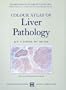 Colour Atlas of Liver Pathology (Oxford Medicine Publications)