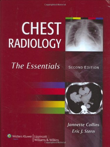 chest radiology the essentials