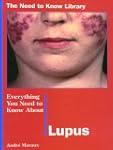 Lupus