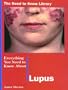 Everything You Need to Know About Lupus (Need to Know Library)