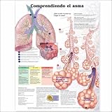Understanding Asthma Anatomical Chart in Spanish (Entendiendo El Asma)