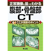 正常画像と並べてわかる腹部・骨盤部CT (ここが読影のポイント)
