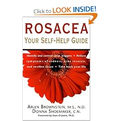 Rosacea: Your Self-Help Guide