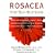 Rosacea: Your Self-help Guide
