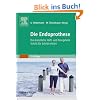 Die Endoprothese: Das k�nstliche H�ft- und Kniegelenk Schritt f�r Schritt erkl�rt