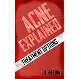 Acne Explained: Treatment Options