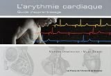 Arythmie cardiaque : Guide d'apprentissage