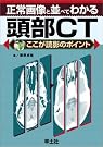 正常画像と並べてわかる頭部CT