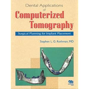 Click here to buy Dental Applications of Computerized Tomography: Surgical Planning for Implant... by Stephen L. G. Rothman.