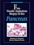 Fine Needle Aspiration Biopsy of the Pancreas