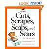 Cuts, Scrapes, Scabs, and Scars (My Health)