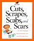 Cuts, Scrapes, Scabs, and Scars (My Health)
