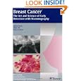 Breast Cancer - The Art and Science of Early Detection with Mammography: Perception,... by Laszlo Tabar, Tibor Tot, and Peter B. Dean