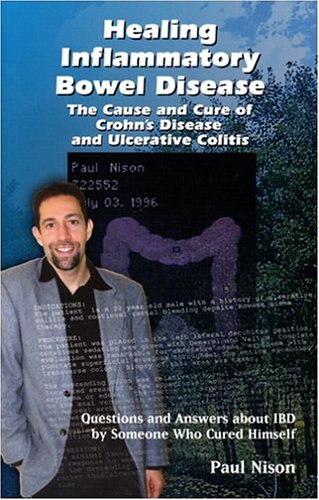 Inflammatory-Bowel-Disease
