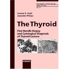 The Thyroid: Fine-Needle Biopsy and Cytological Diagnosis of Thyroid Lesions (Monographs in Clinical Cytology)