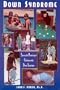 Down Syndrome: Successful Parenting of Children With Down Syndrome