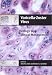 Varicella-Zoster Virus: Virology and Clinical Management