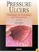 Pressure Ulcers: Guidelines for Prevention and Management