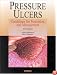 Pressure Ulcers: Guidelines for Prevention and Management