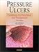 Pressure Ulcers: Guidelines for Prevention and Management by Joann Maklebust ISBN 1582550352