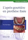 L'apr�s-goutti�re en proth�se fix�e