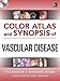 Color Atlas and Synopsis of Vascular Disease