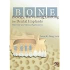 Click here to buy Bone Biology, Harvesting, and Grafting For Dental Implants: Rationale and Clinical... by  Arun K. Garg.