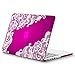 Kuzy - Lace Rubberized Hard Case for Older MacBook Pro 15.4 inch with Retina Display A1398 15 inch Plastic Shell Cover - Lace Raspberry