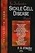 New Developments in Sickle Cell Disease Research