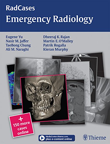 Emergency Radiology (Radcases)