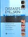 Diseases of the Eye and Skin: A Color Atlas